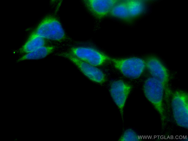SEC63 Antibody in Immunocytochemistry (ICC/IF)