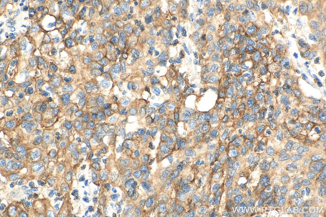 SLC7A5 Antibody in Immunohistochemistry (Paraffin) (IHC (P))