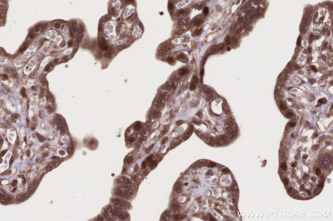 SIRT6 Antibody in Immunohistochemistry (Paraffin) (IHC (P))