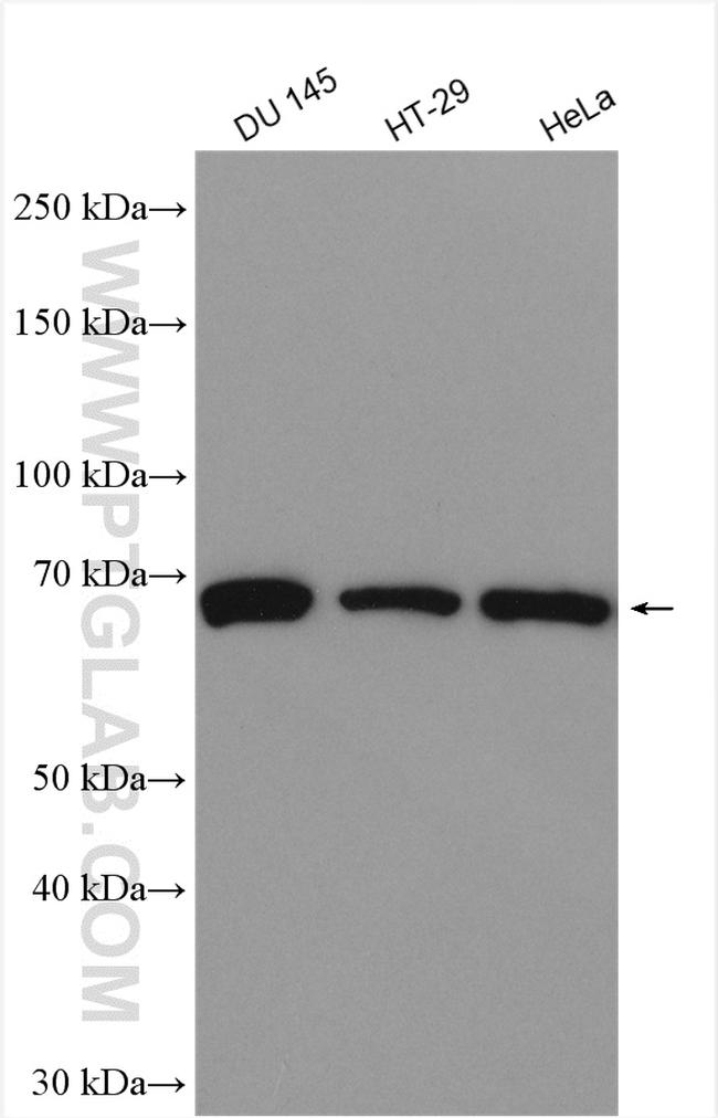 TRABD2B Antibody in Western Blot (WB)