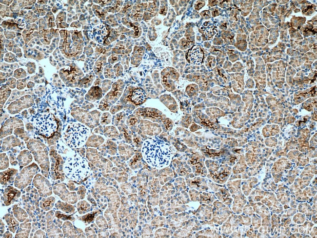 SGLT2 Antibody in Immunohistochemistry (Paraffin) (IHC (P))