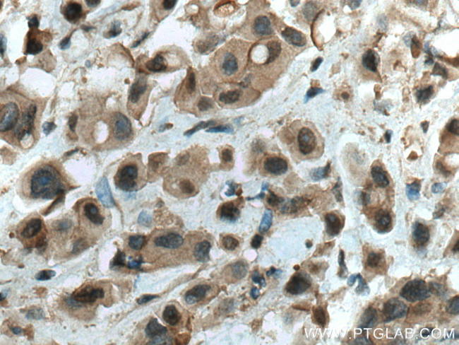 WWP1 Antibody in Immunohistochemistry (Paraffin) (IHC (P))