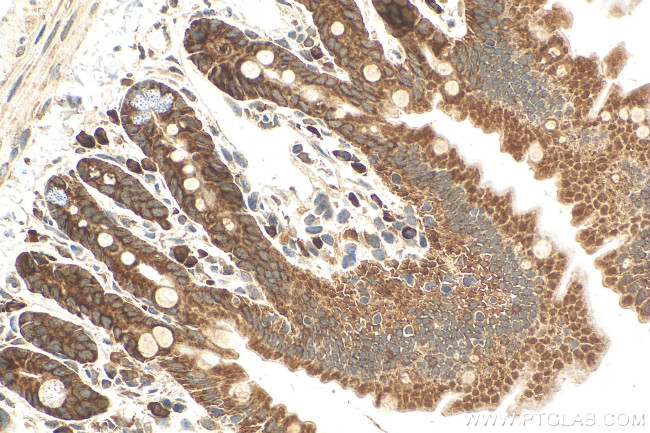 SETD3 Antibody in Immunohistochemistry (Paraffin) (IHC (P))