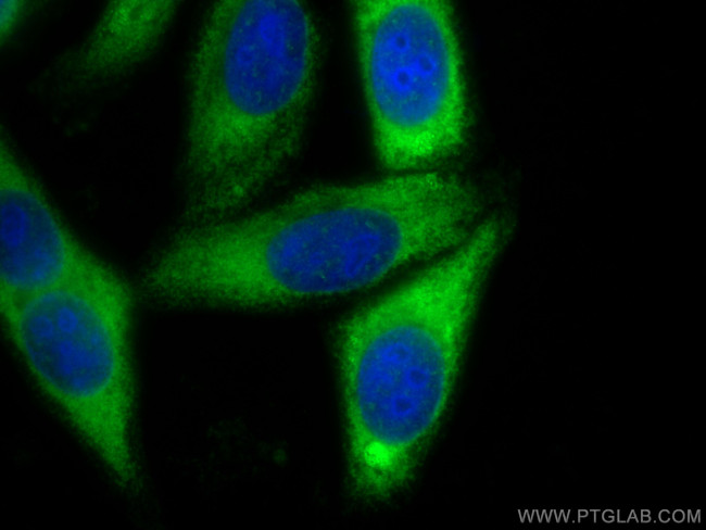 SEC62 Antibody in Immunocytochemistry (ICC/IF)