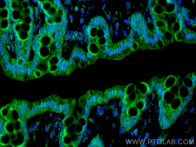 LAMA1 Antibody in Immunohistochemistry (Paraffin) (IHC (P))