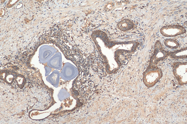 MUC4 Antibody in Immunohistochemistry (Paraffin) (IHC (P))