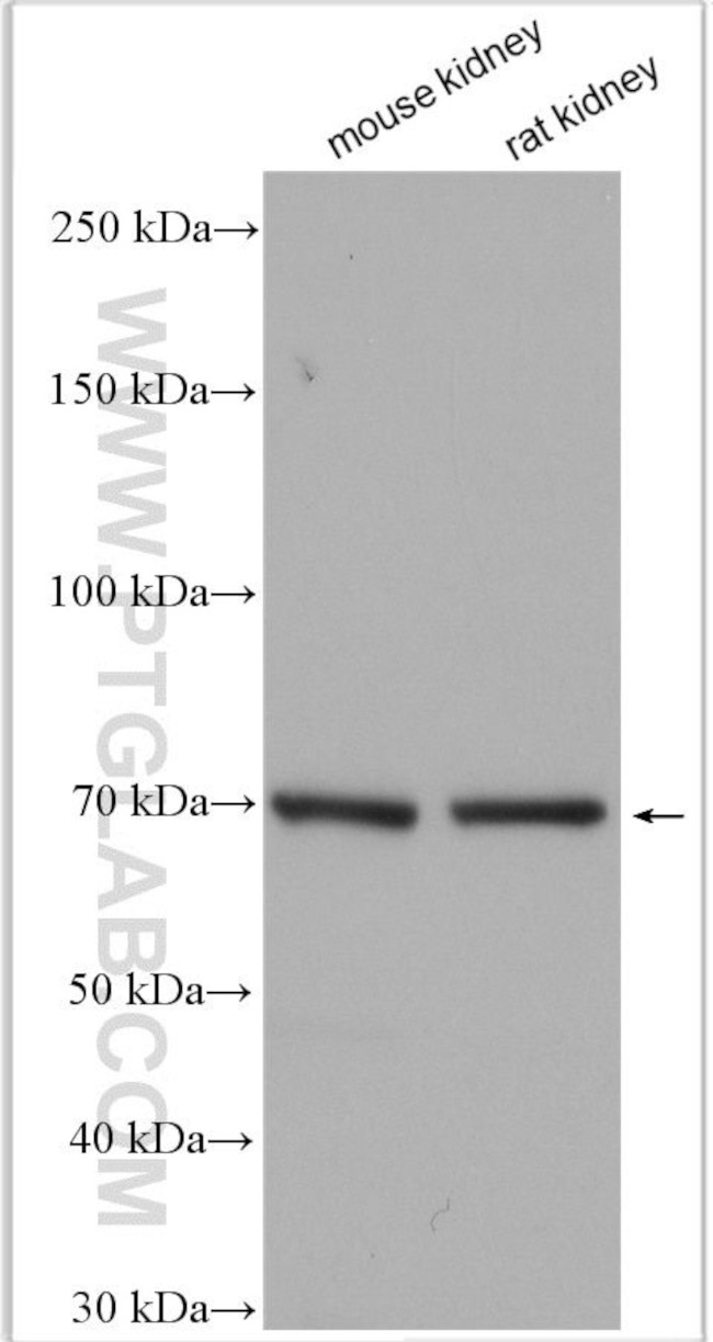 SCNN1A Antibody in Western Blot (WB)