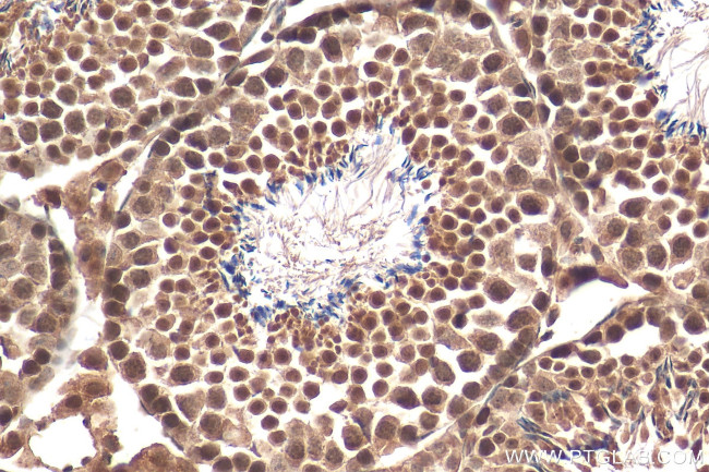 TAF9B Antibody in Immunohistochemistry (Paraffin) (IHC (P))