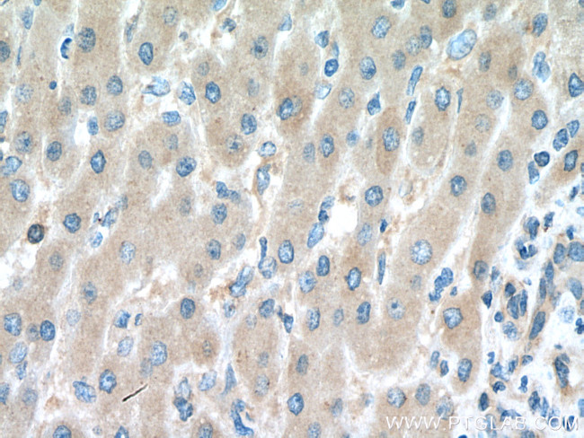 SMCR7/MID49 Antibody in Immunohistochemistry (Paraffin) (IHC (P))