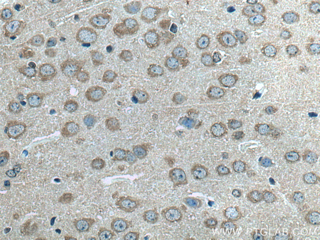 ALG13 Antibody in Immunohistochemistry (Paraffin) (IHC (P))