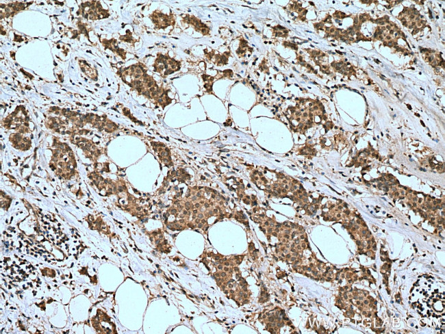 MDMX Antibody in Immunohistochemistry (Paraffin) (IHC (P))
