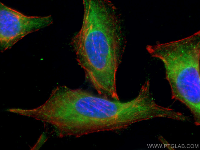 PLK4 Antibody in Immunocytochemistry (ICC/IF)