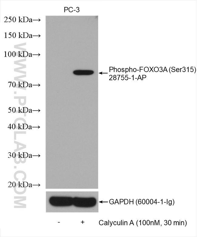 Phospho-FOXO3A (Ser315) Antibody in Western Blot (WB)