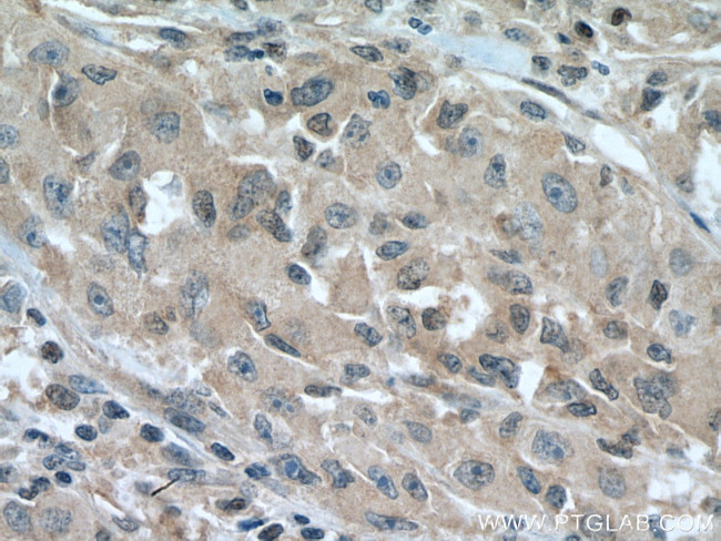 UCKL1 Antibody in Immunohistochemistry (Paraffin) (IHC (P))