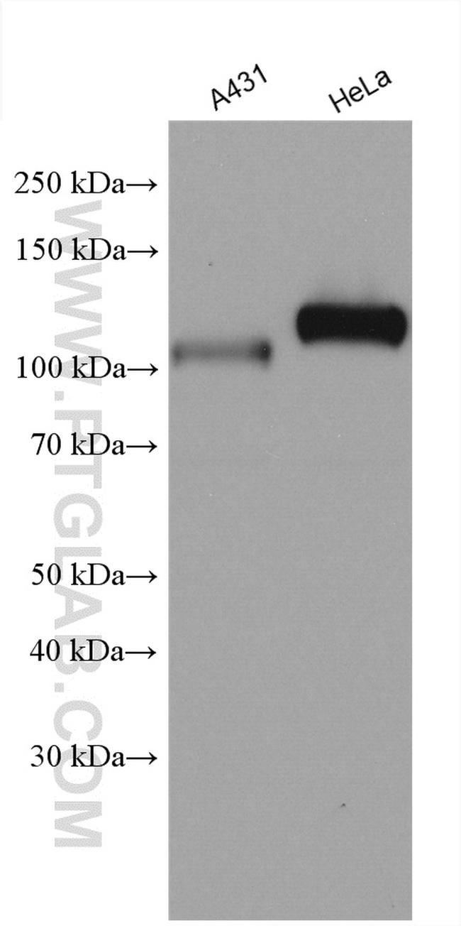 KAT2B Antibody in Western Blot (WB)