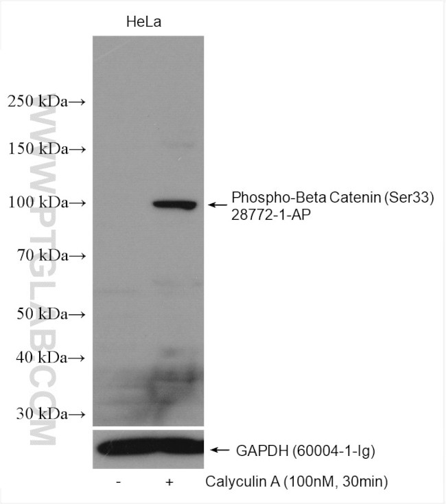 Phospho-Beta Catenin (Ser33) Antibody in Western Blot (WB)