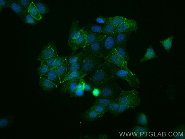 Phospho-Beta Catenin (Ser552) Antibody in Immunocytochemistry (ICC/IF)