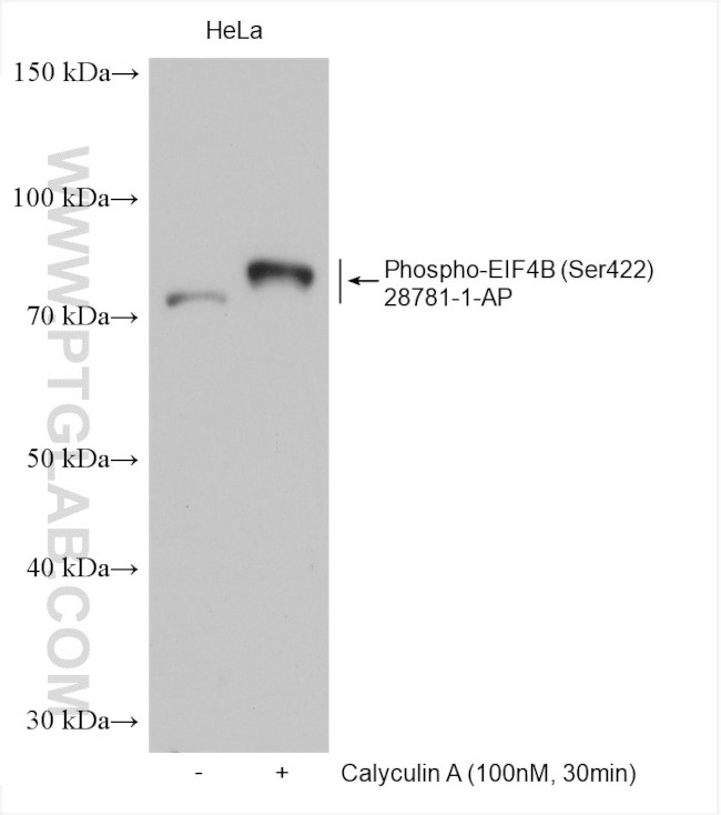Phospho-EIF4B (Ser422) Antibody in Western Blot (WB)