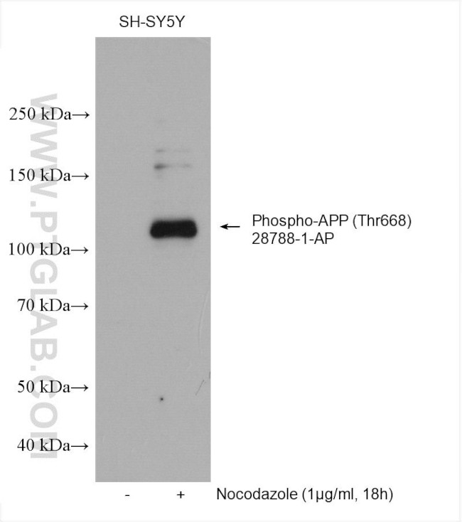 Phospho-APP (Thr668) Antibody in Western Blot (WB)