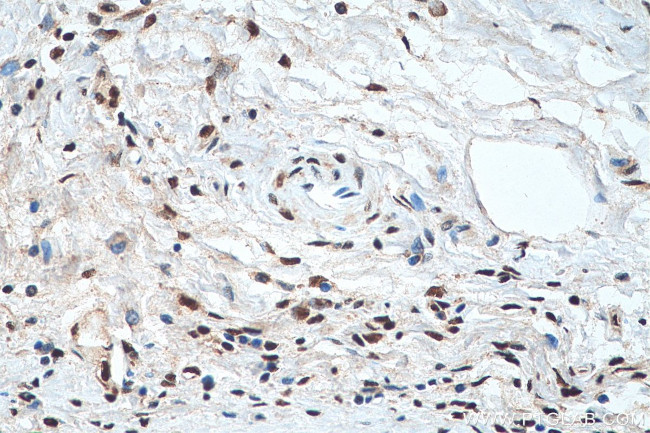 Phospho-CREB1 (Ser133) Antibody in Immunohistochemistry (Paraffin) (IHC (P))