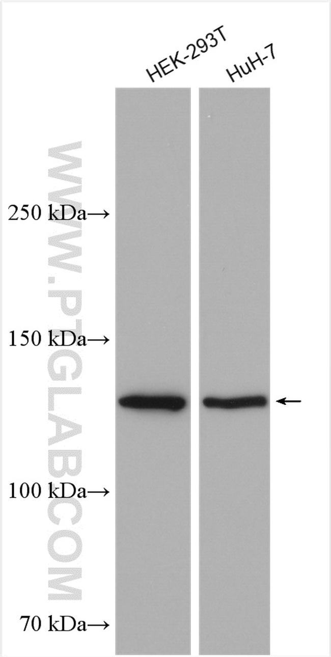 DHX30 Antibody in Western Blot (WB)