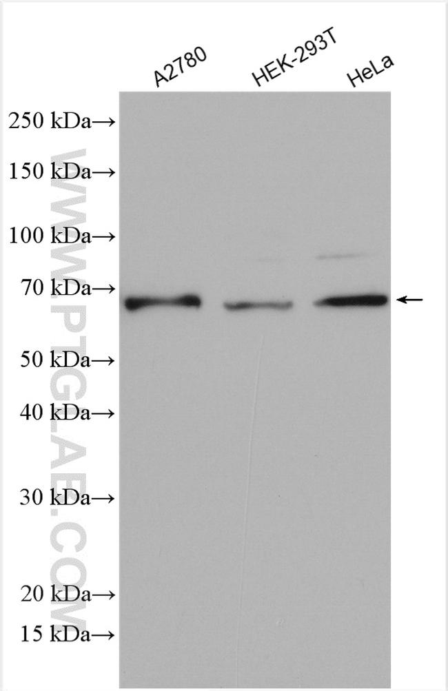 DIS3L2 Antibody in Western Blot (WB)