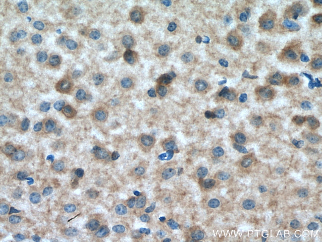 GRM5 Antibody in Immunohistochemistry (Paraffin) (IHC (P))