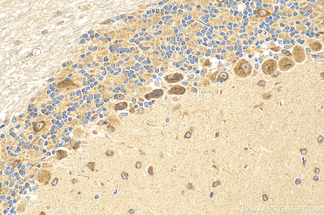 CELSR3 Antibody in Immunohistochemistry (Paraffin) (IHC (P))