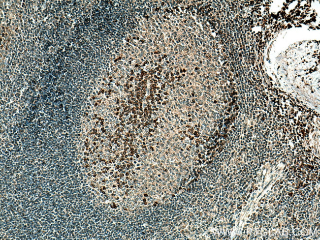 CD1c Antibody in Immunohistochemistry (Paraffin) (IHC (P))