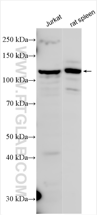 MYO1F Antibody in Western Blot (WB)