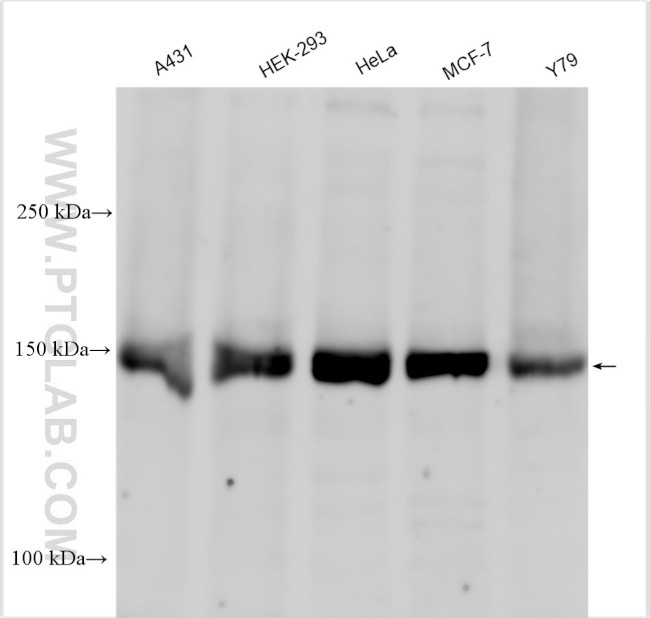 POLR3A Antibody in Western Blot (WB)
