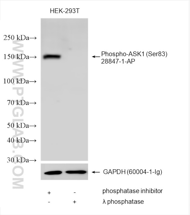 Phospho-ASK1 (Ser83) Antibody in Western Blot (WB)