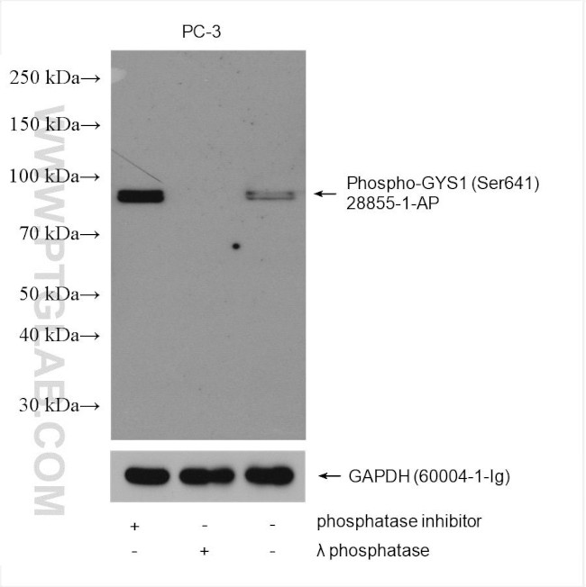 Phospho-GYS1 (Ser641) Antibody in Western Blot (WB)