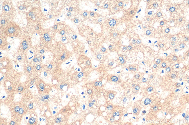 GRB10 Antibody in Immunohistochemistry (Paraffin) (IHC (P))