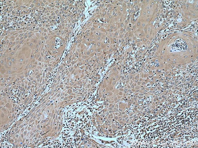 CORO2A Antibody in Immunohistochemistry (Paraffin) (IHC (P))