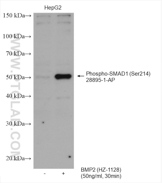 Phospho-SMAD1 (Ser214) Antibody in Western Blot (WB)