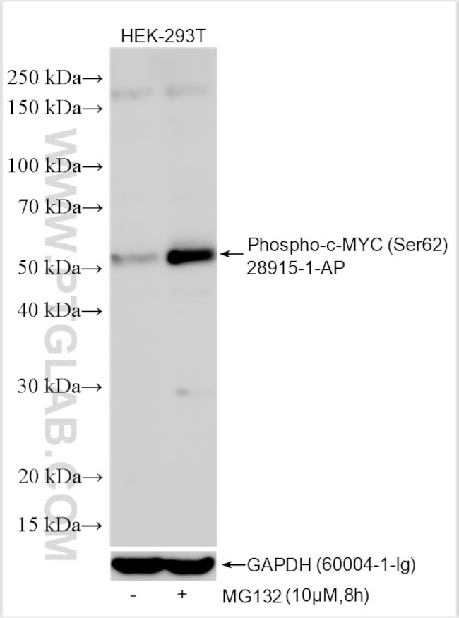 Phospho-c-MYC (Ser62) Antibody in Western Blot (WB)