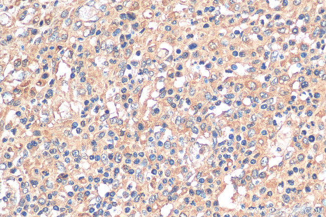 PLA2G4A Antibody in Immunohistochemistry (Paraffin) (IHC (P))