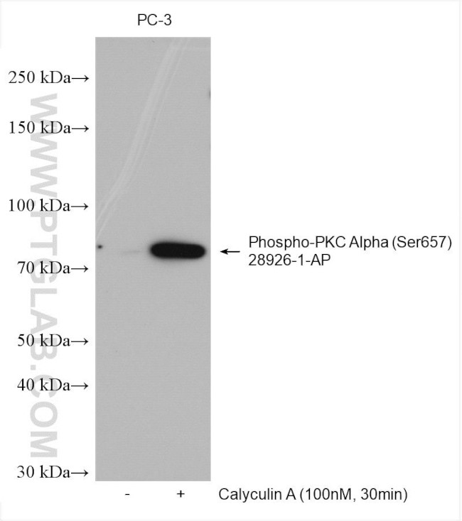 Phospho-PKC Alpha (Ser657) Antibody in Western Blot (WB)