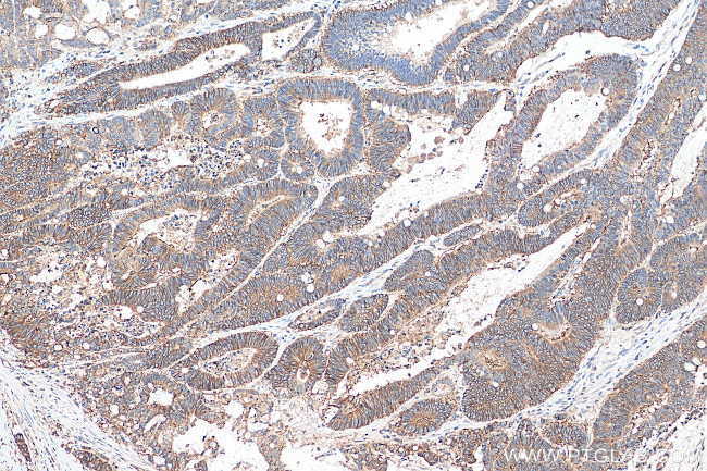 CD46 Antibody in Immunohistochemistry (Paraffin) (IHC (P))