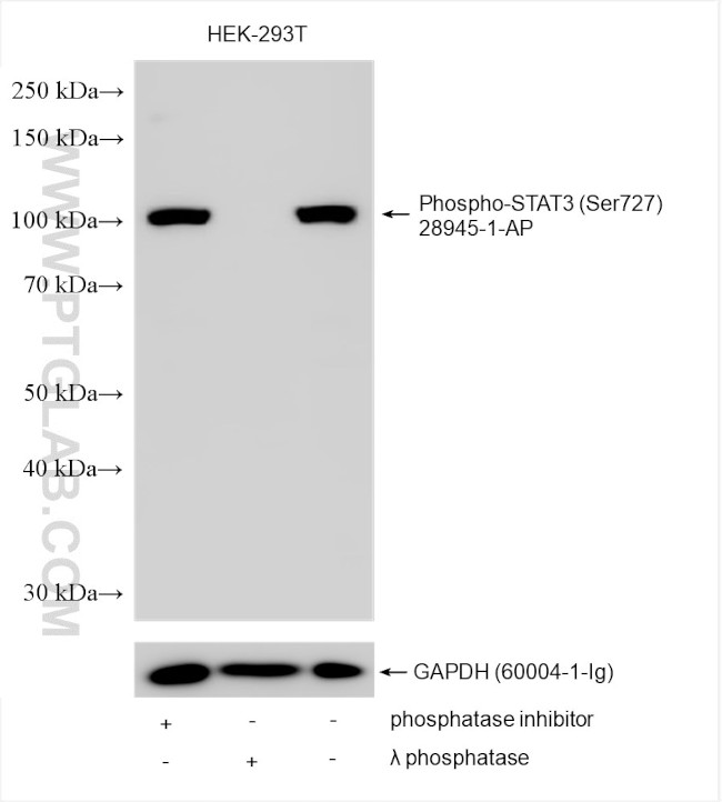 Phospho-STAT3 (Ser727) Antibody in Western Blot (WB)