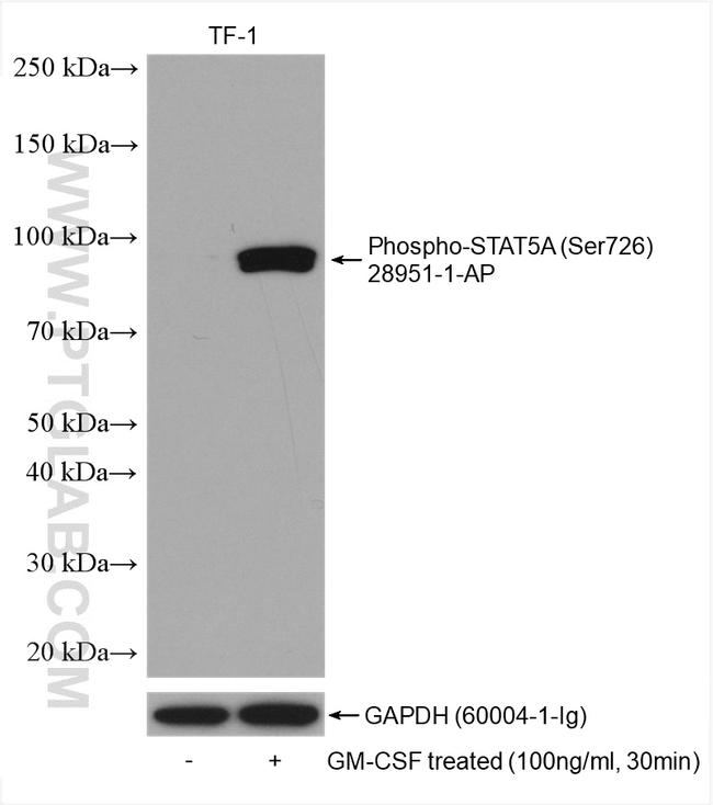 Phospho-STAT5A (Ser726) Antibody in Western Blot (WB)
