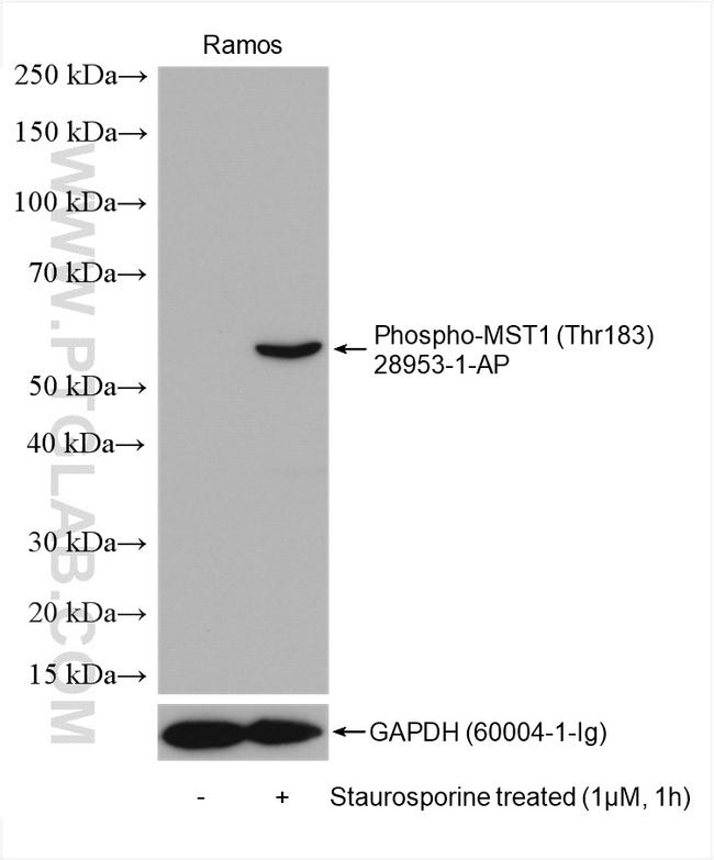 Phospho-MST1 (STK4) (Thr183) Antibody in Western Blot (WB)