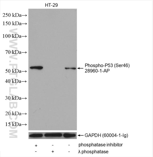 Phospho-P53 (Ser46) Antibody in Western Blot (WB)