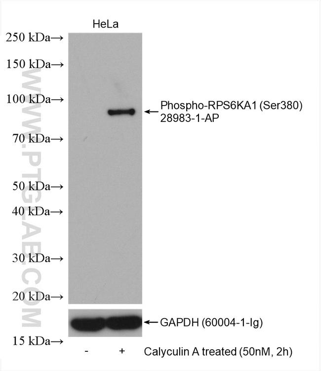 Phospho-RPS6KA1 (Ser380) Antibody in Western Blot (WB)