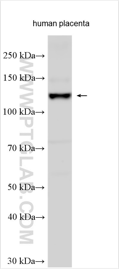TGFBR3 Antibody in Western Blot (WB)