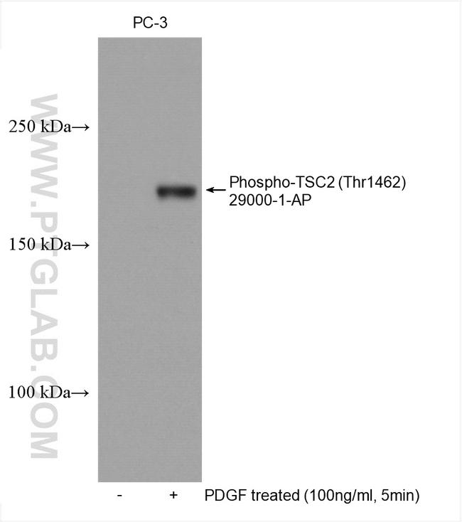 Phospho-TSC2 (Thr1462) Antibody in Western Blot (WB)