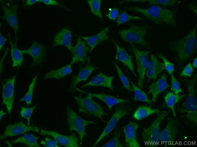 ULK1 Antibody in Immunocytochemistry (ICC/IF)