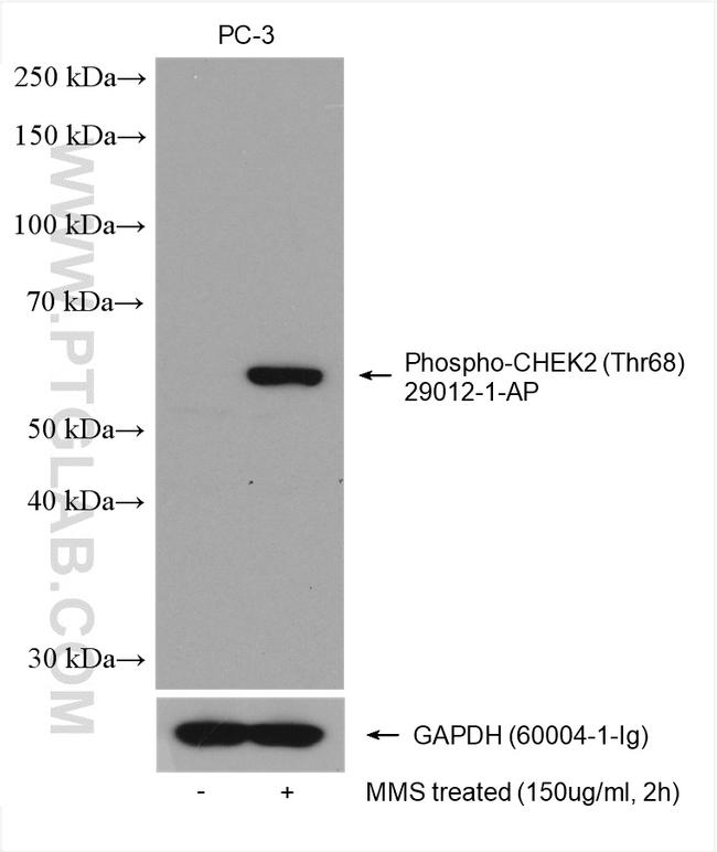 Phospho-CHEK2 (Thr68) Antibody in Western Blot (WB)