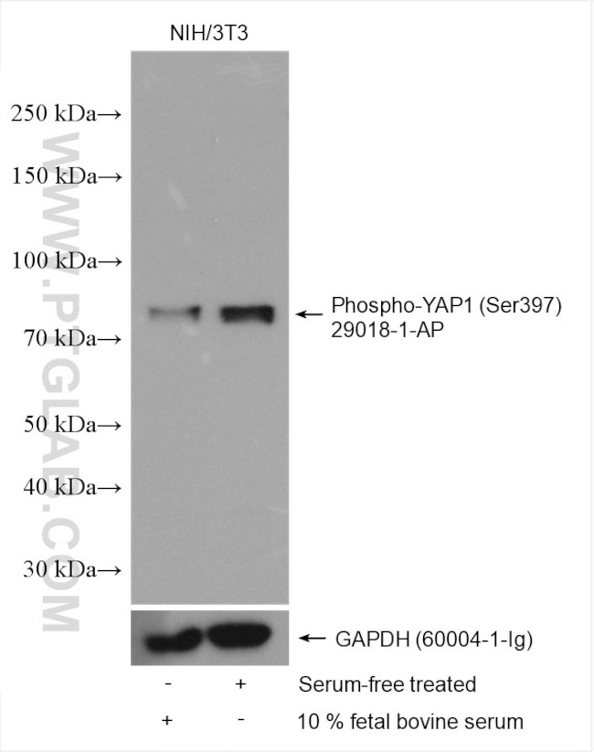 Phospho-YAP1 (Ser397) Antibody in Western Blot (WB)